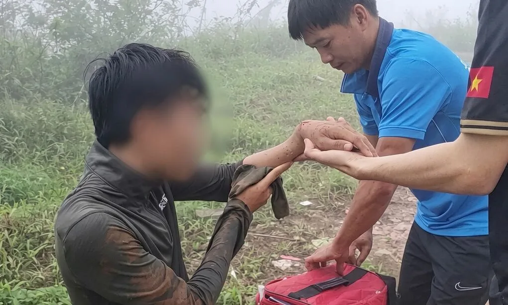 비 오는 날 바덴산 등반하던 관광객 미끄러져 팔 골절